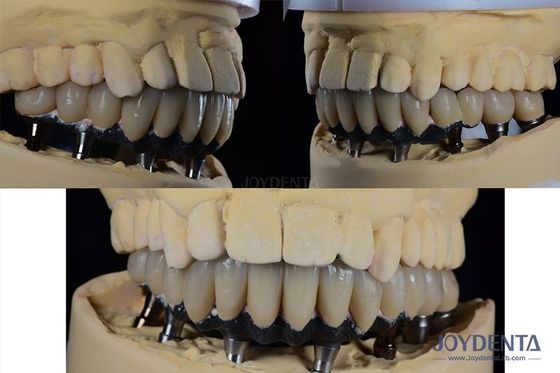 kupować Tytanowy implant zębowy z wieloma zębami Protetyczna chirurgia Zewnętrzne sześciokątne połączenie produkcja online