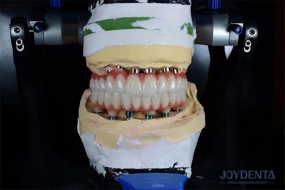 kupować 10 mm długości implant zęba gamma napromieniowany dla optymalnych wyników operacyjnych produkcja online