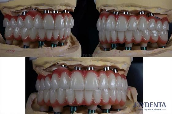 kupować 10 mm Implant zębów wielopłaszczyznowych z tytanu produkcja online