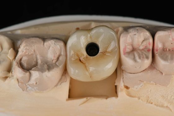 kupować Tytuł 10 mm Jednopęty Implanty Zębowe Zastąpienie Abutment Samodzielne Tapping Piaszczyste produkcja online