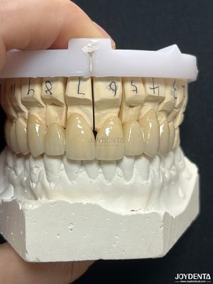 kupować Bezszwowe PFM Porcelanowe stopione korony metalowe do długoterminowej biokompatybilnej odbudowy produkcja online