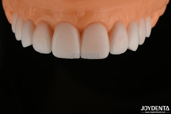 kupować Gładki, replikowany, diagnostyczny wosk FDA, pełny łuk wosku zębów bardzo precyzyjny produkcja online