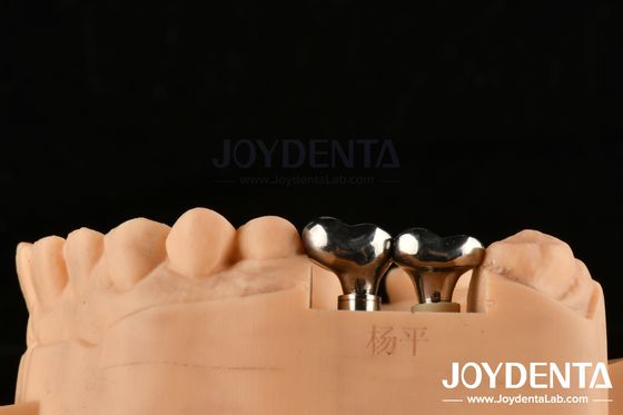 kupować Srebro Implanty Zębowe Abutments Dostosowalna średnica Wysokość CAD CAM Technologia produkcja online