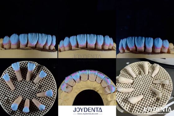 kupować Wysoka biokompatybilność Glossy Feldspatic Ceramic Veneer For Dental Restorations produkcja online
