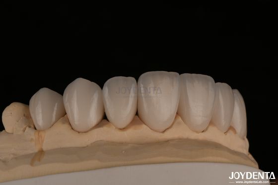 kupować Feldspaticzne naturalnie wyglądające finery kosmetyczne Precyzyjne dopasowanie Wysoce przezroczyste produkcja online