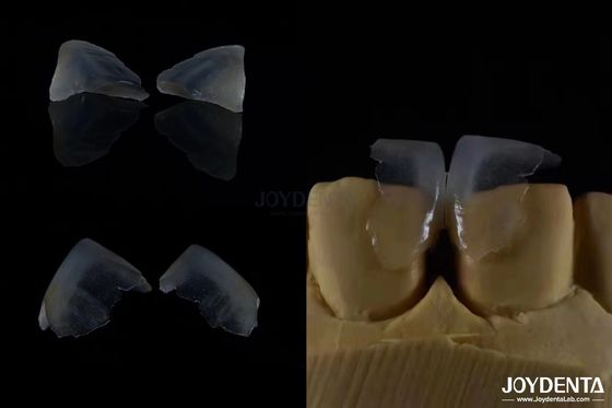 kupować Minimalnie inwazyjne kosmetyczne finery stomatologiczne Szklane ceramiczne Kolor ultra cienkie produkcja online