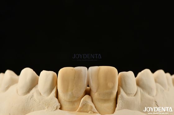 kupować 0.2mm Grubość Mikrotinowe finery Szklane ceramiczne finery stomatologiczne do zębów przednich produkcja online
