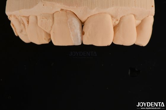 kupować Mikrofolie z cienką powłoką Kosmetyczne zabiegi stomatologiczne Mikrofolie z cienkimi zębami produkcja online