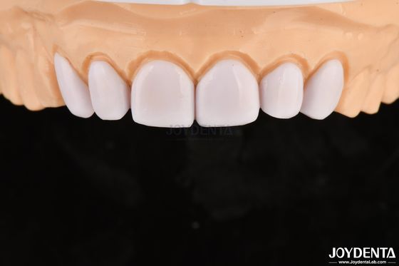 kupować Szkło ceramiczne do wybielania zębów produkcja online