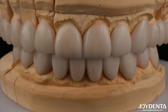 kupować 0.3mm Grubość Ips Emax Finery Finery ceramiczne Przednie tylne Restauracje produkcja online