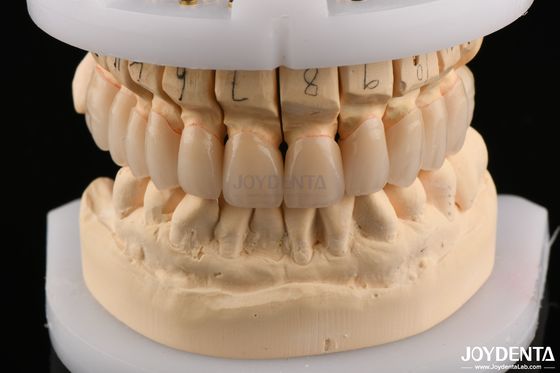 kupować Polerowana powierzchnia Wytrzymałość na gięcie Zwierzchnia z warstwami Zirkonia do mostów 6.0-6.1 G/cm3 Gęstość produkcja online
