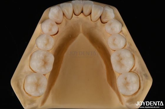 kupować 3D wielowarstwowe stomatologiczne pełne cyrkonia odporność na szczeliny naturalna struktura zęba produkcja online