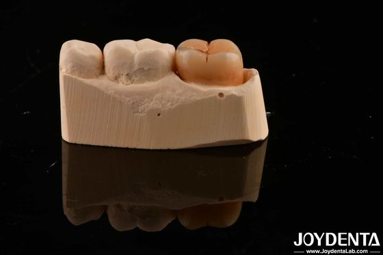 kupować Materiał odbudowy zębów wielowarstwowy pełny cyrkonia 1200 HV twardość odporność na pęknięcia produkcja online