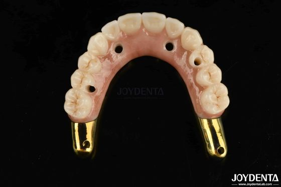 kupować Odporność na zużycie Zirconia Hybrid Bridge z Ti-Bar Kompatybilne naturalne zęby i dziąsła produkcja online