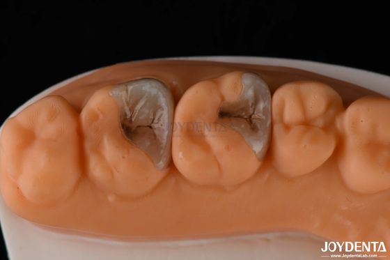 kupować Kompozytowe wkładki i wkładki do odbudowy zębów produkcja online