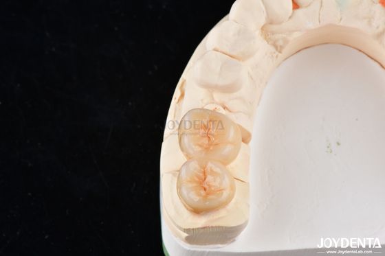 kupować Naturalnie wyglądające zębowe wkładki z cyrkonii i wkładki wysokiej estetycznej precyzji produkcja online
