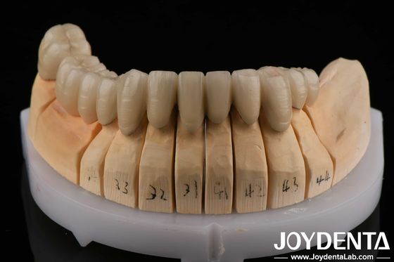 kupować Złoty stop PFM Porcelana stopiona do metalu Dental Kompatybilny z warstwą porcelany produkcja online