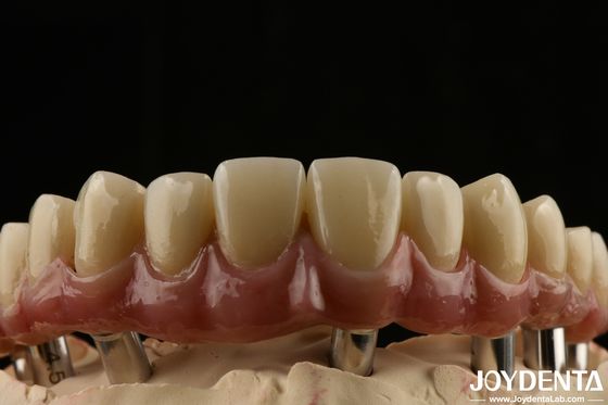 kupować Titanium Malong Dental Hybrid Bridge Długotrwałe Dostosowane do warunków niskiej gęstości produkcja online