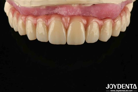 kupować Komfortowe noszenie Titanium Malong Hybrid Bridge Dental Regular Design Lekkie produkcja online