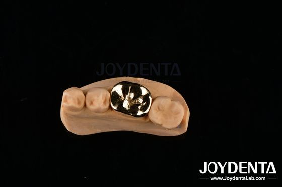 kupować Metalowe FMC Doustna naprawa kliniczna Materiały do implantów dentystycznych odporne na ścieranie produkcja online
