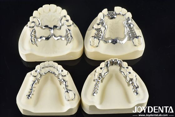 kupować Odstępowa konstrukcja ramy dentystycznej do pasującej do ust wspierającej żucie produkcja online