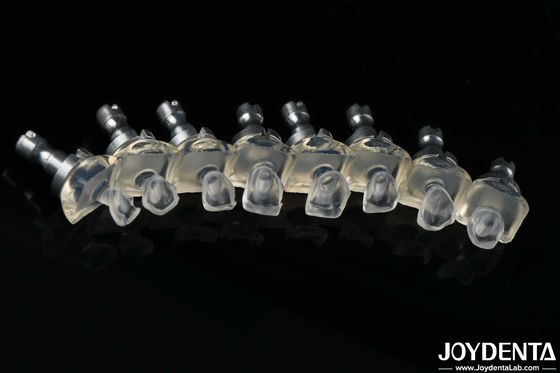 kupować Wysokoprzezroczyste szkło porcelanowe finery zębowe Wysoka wytrzymałość 0,3-0,8 mm grubość produkcja online