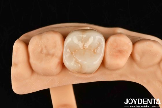 kupować Wysoka odporność na zużycie Dentalne Zirkonia pełna Wysoka wytrzymałość pełny kontur Zirkonia most produkcja online