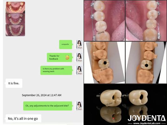 kupować Długotrwałe implanty zębowe z pełnym łukiem Długość implantów endosesowych 10 mm-16 mm produkcja online