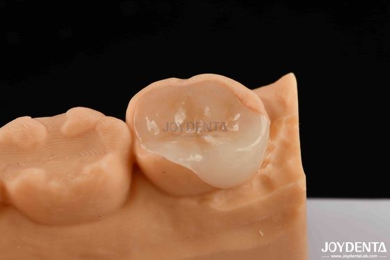 kupować Polymerowana porcelana kompozytowa, estetyczna i trwała produkcja online