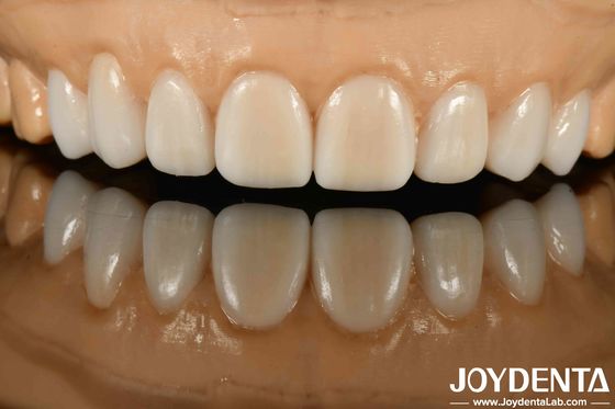 kupować Wysoka niewidoczność Różnorodne materiały z metali i żywic Elastyczne wykończenie protezy do zaawansowanej technologii niewidoczności produkcja online