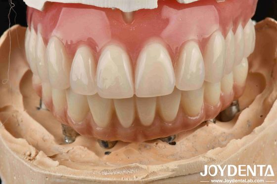 kupować Dobry elastyczność dentystyczna proteza akrylowa wykończenie z technologii układu zębów produkcja online