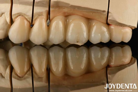 kupować Biały pełny cyrkon z wysoką odpornością na wstrząsy cieplne Wysoka wytrzymałość produkcja online