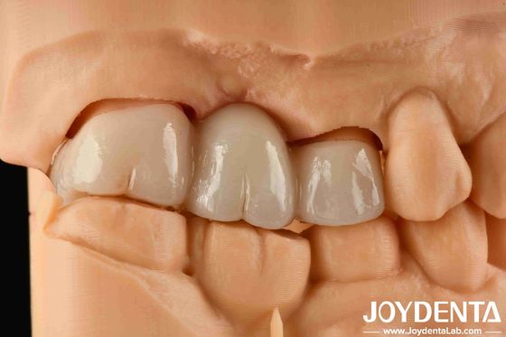 kupować Doświadczenie Kolor realistyczny Zirkonia pełna z wysoką odpornością na farbowanie i wytrzymałości gięcia 1000 MPa produkcja online