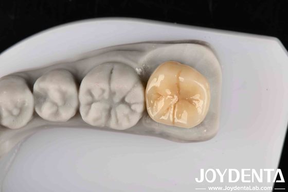 kupować Wysoka odporność na wstrząsy cieplne i korozję pełny cyrkon z doskonałą stabilnością chemiczną produkcja online