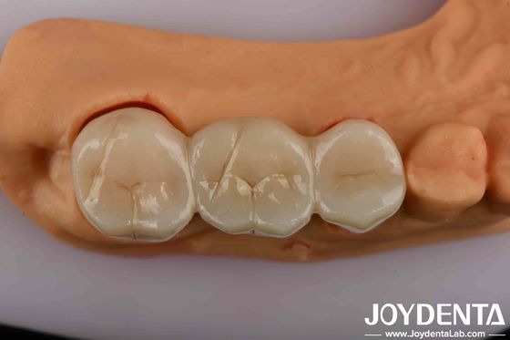 kupować Wysokiej wytrzymałości cyrkonia stomatologiczna Twoje najlepsze rozwiązanie dla naturalnej estetyki produkcja online