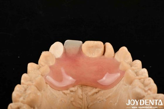 kupować Wysoka niewidoczność Dobra elastyczność Elastyczna proteza do różnych procesów produkcyjnych produkcja online