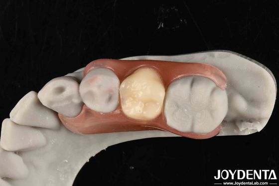 kupować Zrewolucjonizuj swoją praktykę stomatologiczną. Zestaw zębów z wyrafinowaną technologią od dentystów. produkcja online