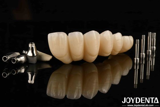 kupować Doświadcz ostatecznej estetyki z estetycznie przyjemnym implantem dentystycznym Korona i most produkcja online