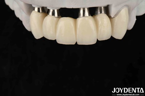 kupować Dostosowywalna korona i mostek z implantami dla bezpiecznej kompatybilności biologicznej doustnej produkcja online