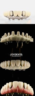 kupować Stomatologiczny estetyczny titanowy most Malong Hybrid Ultimate Solution For Dental Restorations produkcja online