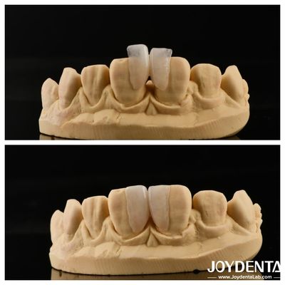 kupować Łatwe do zainstalowania Mikrofojer Ostateczne rozwiązanie dla dekoracji wnętrz Grubość 0,2 mm produkcja online