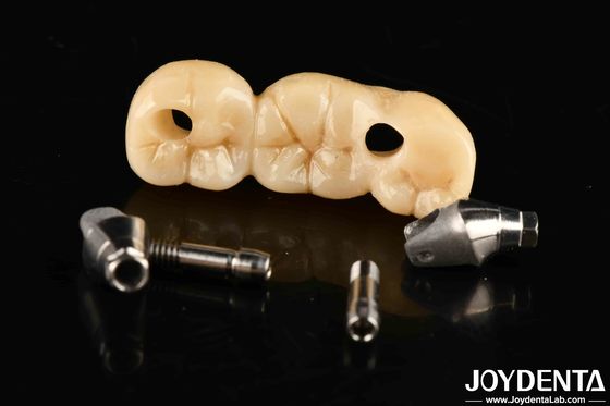 kupować Implant Korona i most z dostosowalnym projektem Wysoka wytrzymałość Dokładny dopasowanie produkcja online