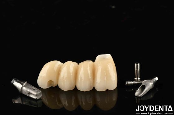 kupować Zastosowalna korona i mostek z porcelany dla doskonałej funkcji produkcja online
