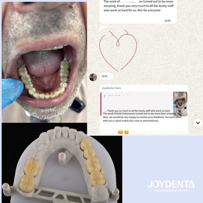 kupować Zęby z cyrkonia, naśladujące naturalne zęby produkcja online