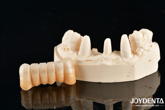 kupować Unveil True Biomimicry: Introducing Our Multi-Layered Zirconia Aesthetic Bridge produkcja online