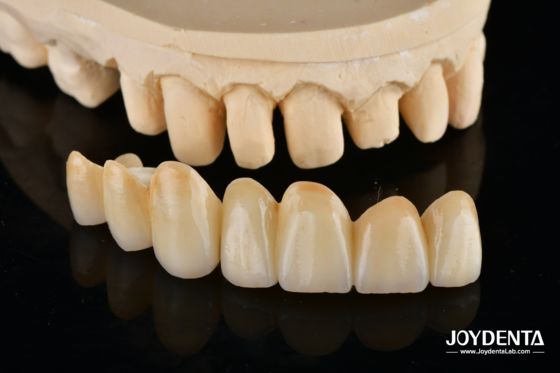 kupować Unveil True Biomimicry: Introducing Our Multi-Layered Zirconia Aesthetic Bridge produkcja online