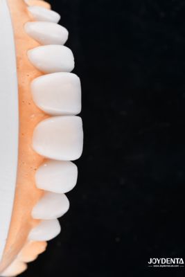 kupować Enhance Case Acceptance & Patient Communication with Our Diagnostic Wax-Up Service produkcja online