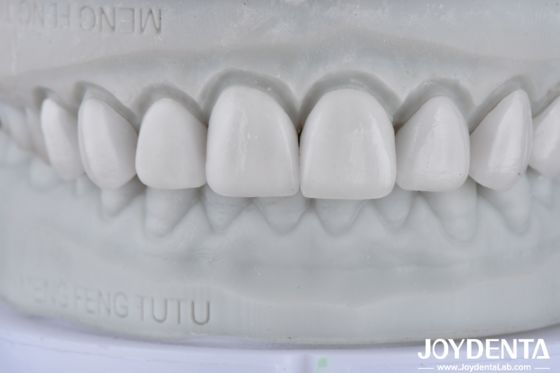 kupować Visualize the Result, Secure the Case: Our Diagnostic Wax-Up Service produkcja online