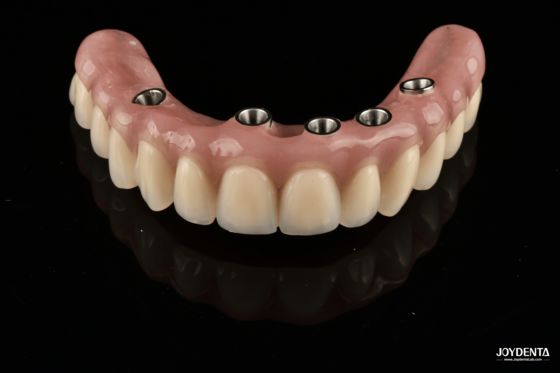 kupować Redefining Full Arch Prosthetics: Unmatched Fit and Function with Our Ti-Base Complete Dentures produkcja online
