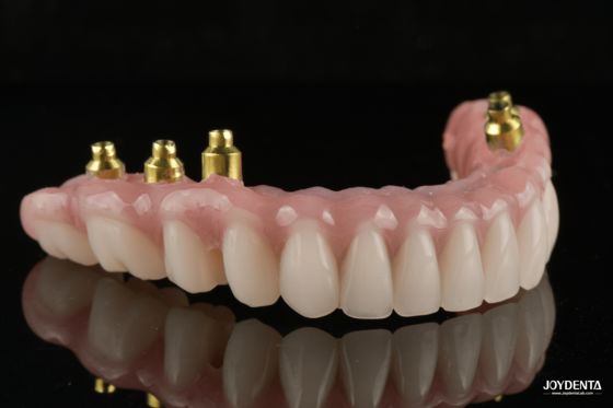 kupować The Strength of Titanium, The Art of Natural Aesthetics. produkcja online